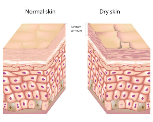 Humectants and Dry Skin
